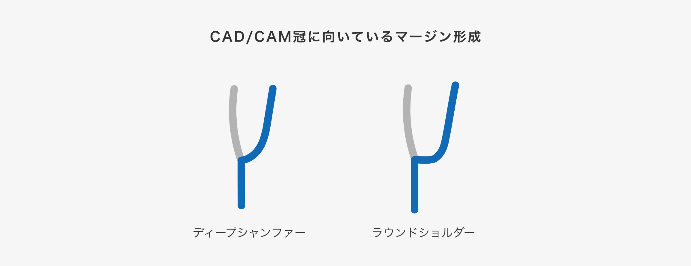 CAD/CAM冠に向いているマージン形成(ディープシャンファー/ラウンドショルダー)の図解